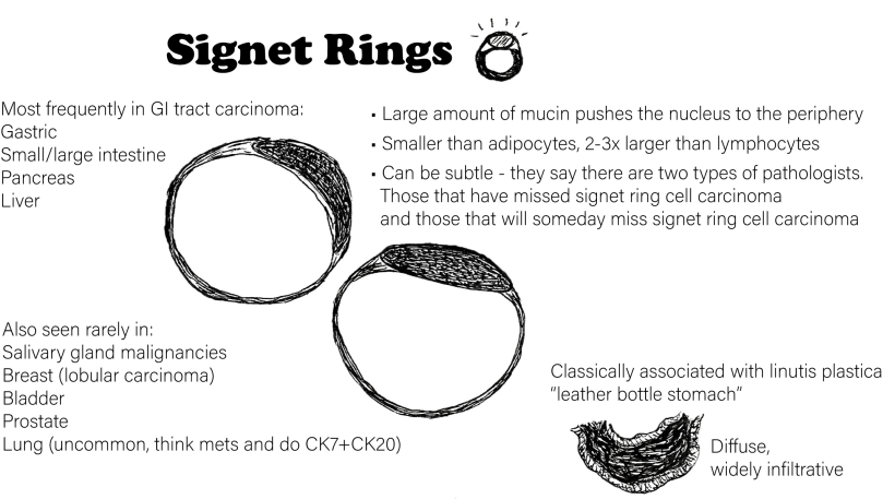 Day 1 - Signet Rings
